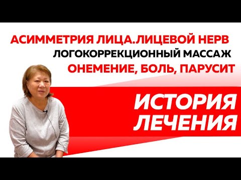 Логопедический массаж при асимметрии лица. Онемение, боль. Лицевой нерв, парусит