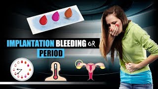 Implantation bleeding - What is Difference between Implantation Bleeding and Periods