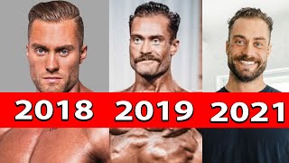 Chris Bumstead - 3 Years on Finasteride! Finasteride Enough to Keep His Hair?
