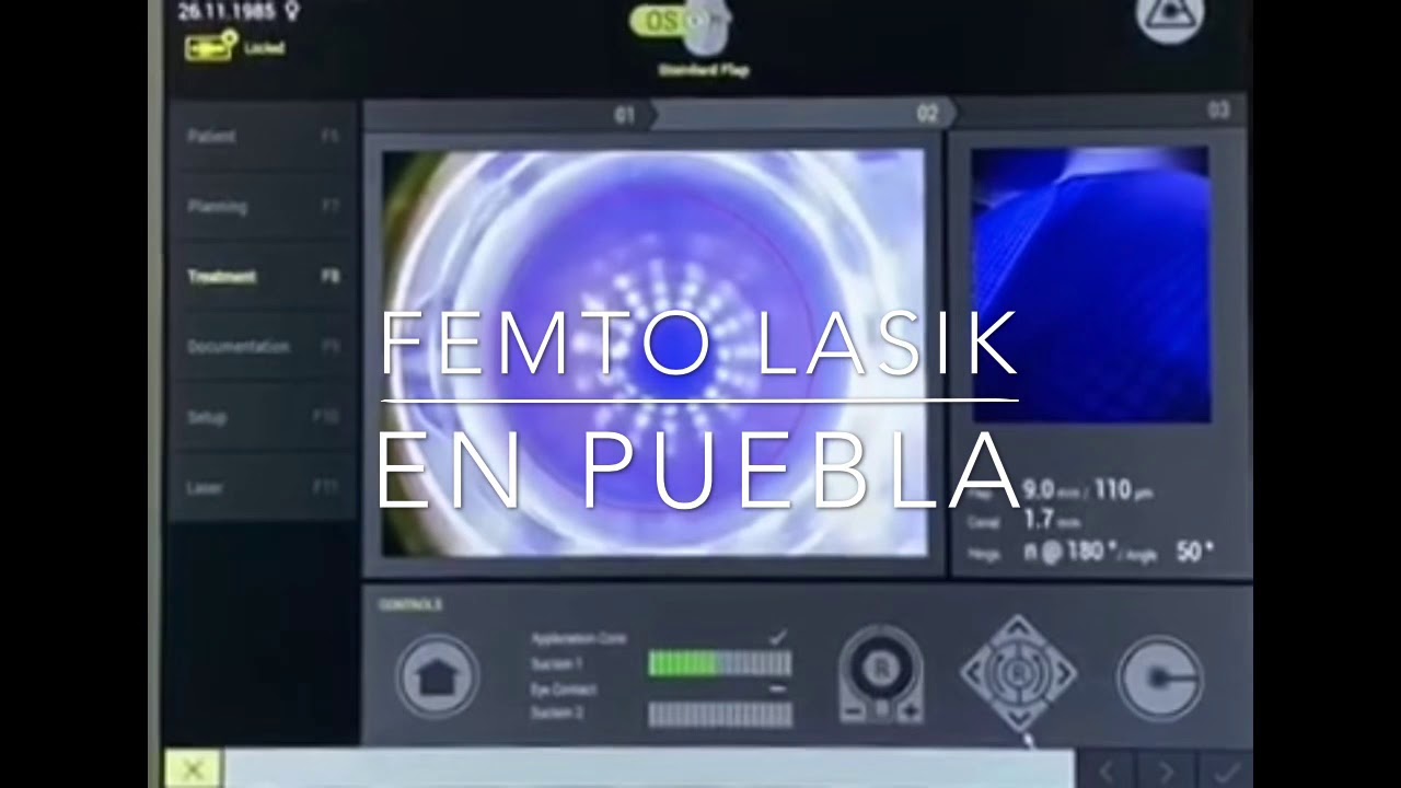 Jorge Alberto Martínez Mendoza-14