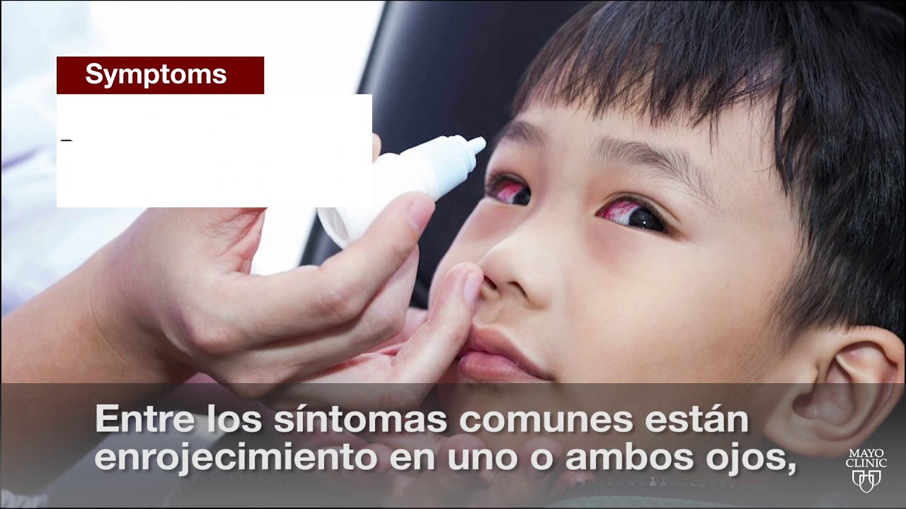 El minuto de Mayo Clinic: <br />¿Qué hay que saber sobre la conjuntivitis