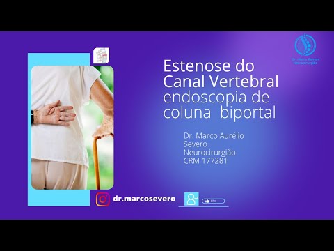 Marco Aurélio Severo Da Silva Versiani-86