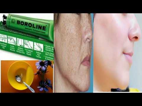 download lagu mp3 mp4 Boroline For Pigmentation, download lagu Boroline For Pigmentation gratis, unduh video klip Boroline For Pigmentation