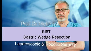 Miniaturka - GIST. Gastric wedge resection. .Metin Ertem MD.FACS