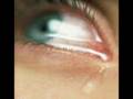 Bliss tearing eyes by Dead Poetic 
