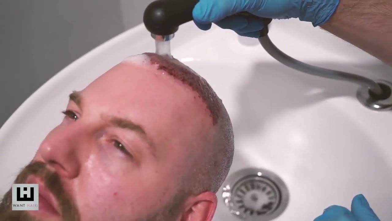 Video 1