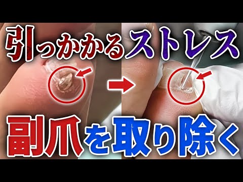 施術動画4