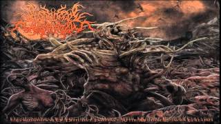 (FULL ALBUM) Postcoital Ulceration - Continuation of Defective Existence After Multiple...