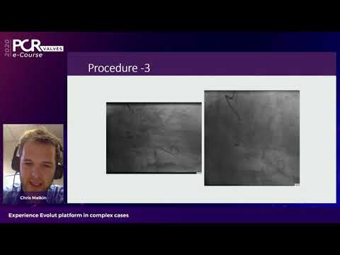 Experience the Evolut platform in complex cases - PCR Valves e-Course 2020