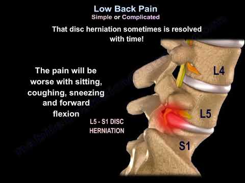 Low Back Pain Simple or Complicated - Everything You Need To Know - Dr. Nabil Ebraheim