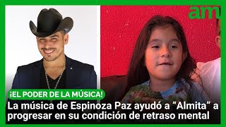 Niña supera retraso mental gracias a la música de Espinoza Paz
