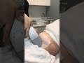 POV: life after saying goodbye to stubborn belly fat ✨