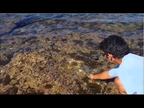 Mezzi da vermi per la gente Helminths in sintomi di canali biliari