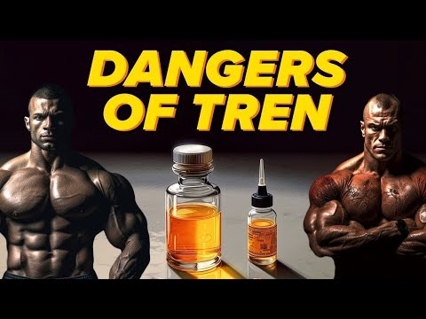 Is TREN Worth the Risk? The Good, The Bad & The Ugly