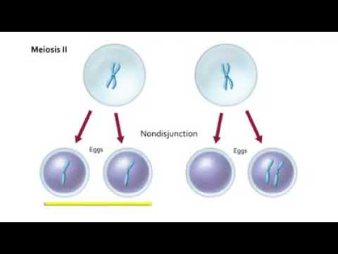 Non Disjunction in Meiosis | Non disjunction Meiosis