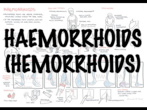 Haemorrhoids (Hemorrhoids) - Overview (pathophysiology, investigations and treatment)