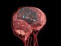 Ischaemic Stroke Animation