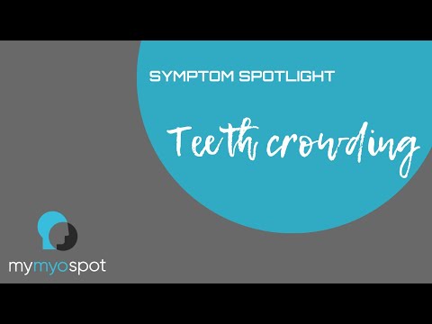 Symptom Spotlight - Teeth Crowding