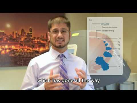 Bladder Cancer Basics