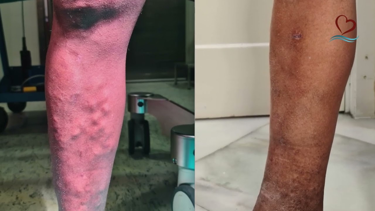 José Francisco Valderrama Marcos-14