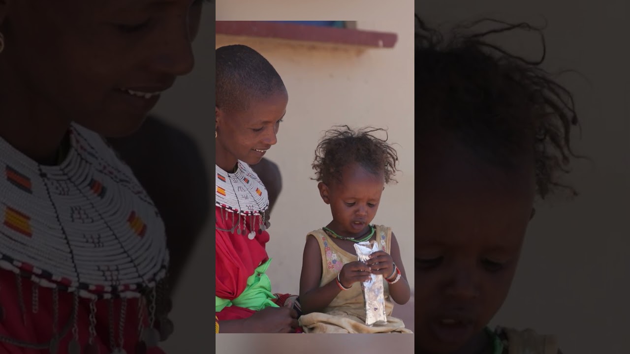 How we treat severe malnutrition