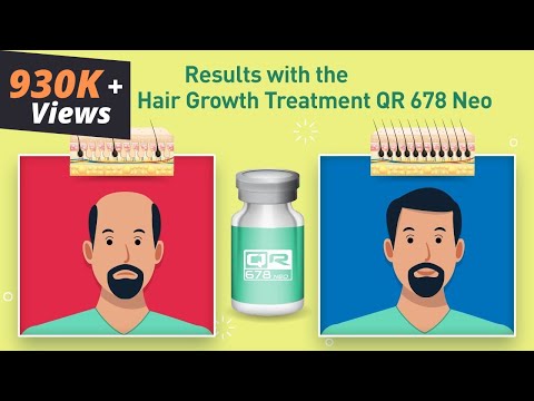 Qr 678 treatment for hair growth in alopecia areata treatmen...