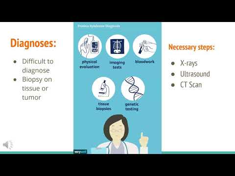 Presentation proteus syndrome