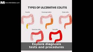 Ulcerative Colitis In Children: Causes, Symptoms & Care Guide Video