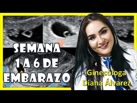 Weeks 1-6 of Pregnancy: Everything You Need to Know! | Gynecologist Diana Alvarez