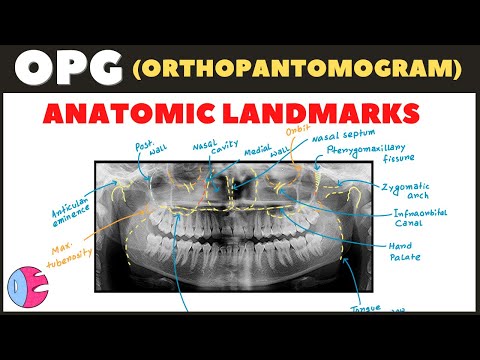 Orthopantomogram (OPG) Anatomical Landmarks / Panoramic Radiography landmarks - Radiology