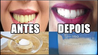 DENTES BRANCOS NA HORA!!! | Bianca Loureno