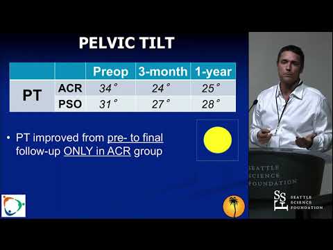 The Role of Anterior Column Reconstruction in Spine Surgery - Robert K. Eastlack, MD