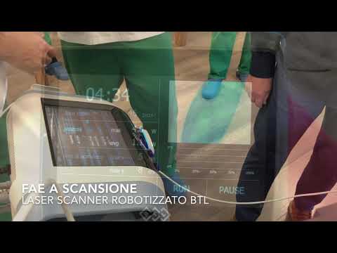 Laser Scan robotizzato dott. De Santis