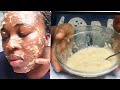Beauty  Busters: How To Use Banana To Clear & Hydrate Your Skin| Face Mask
