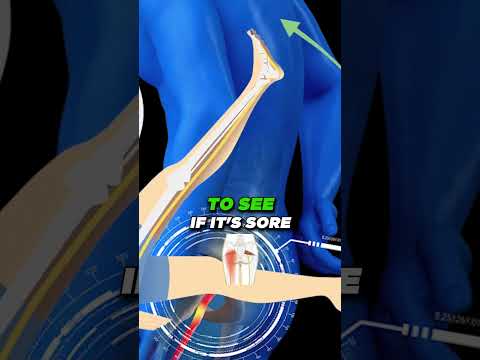 Burning Tingling Numbness in Feet Legs Tarsal Tunnel Syndrome