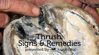 Thrush: Signs and Remedies