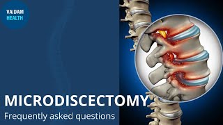 Microdiscectomy - Frequently Asked Questions