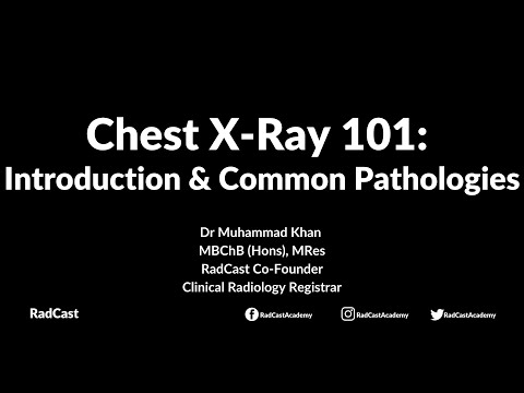 RadCast Academy: Introduction To The Chest X-Ray & Common Pathologies #cxr #radcast