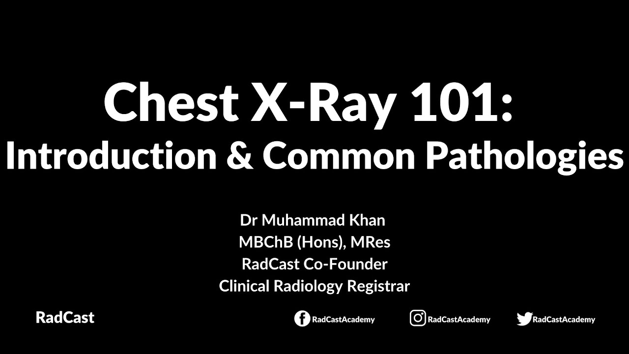 RadCast Academy: Introduction To The Chest X-Ray & Common Pathologies #cxr #radcast