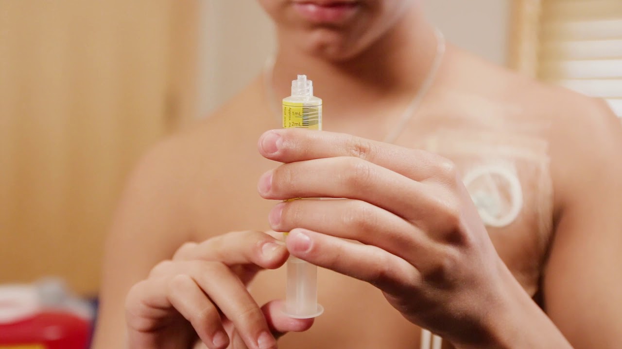 View these step-by-step instructions for a Heparin flush