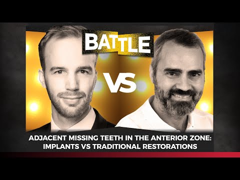 Adjacent missing teeth in the anterior zone: implants vs traditional restorations | Battle