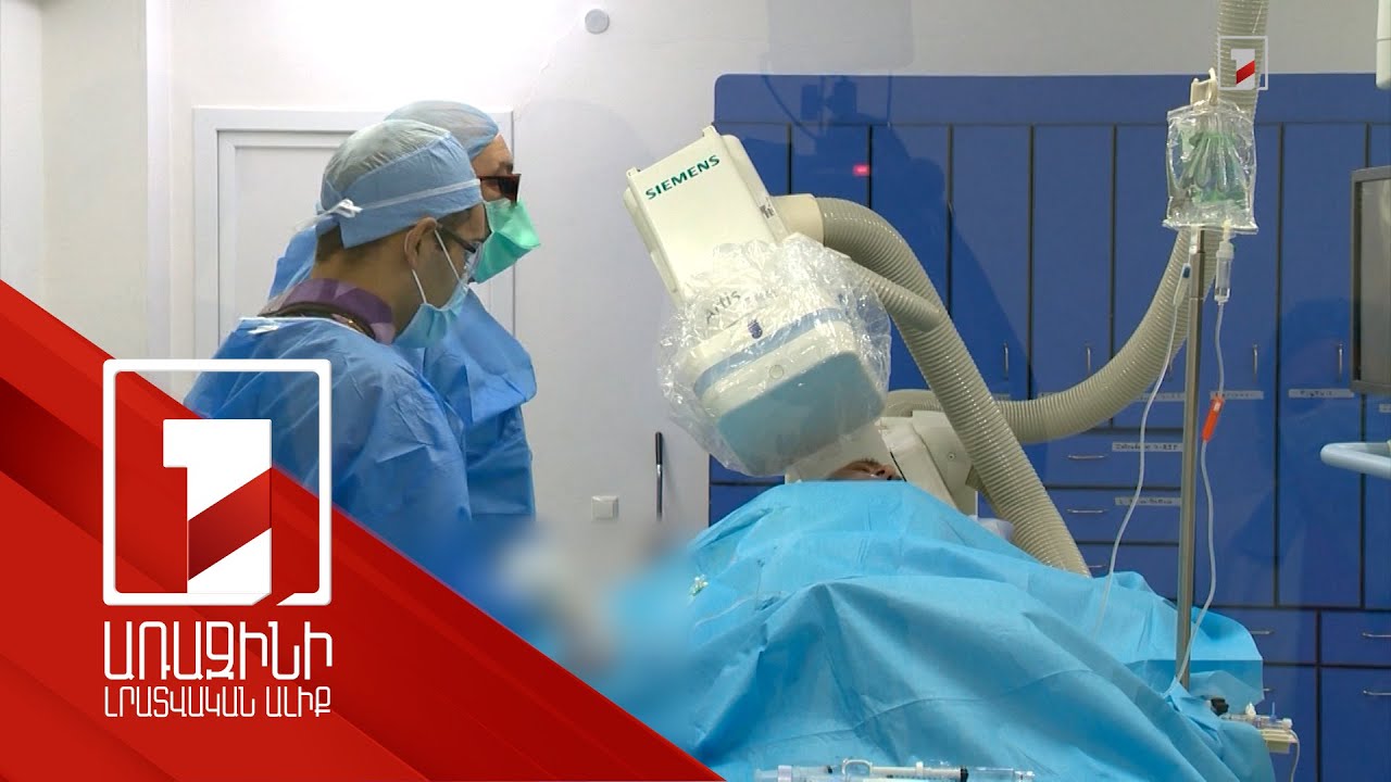 Սրտի անհետաձգելի վիրահատության անվճար ծրագրի շնորհիվ նվազել է մահացության ցուցանիշը