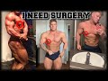 How To Get Rid Of Gyno | My Gynecomastia Experience