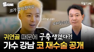 가수 강남, 코 재수술 공개! (feat.귀연골👂)｜코성형｜김종구 원장