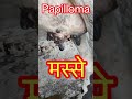 Papilloma L Warts L Dr Umar Khan