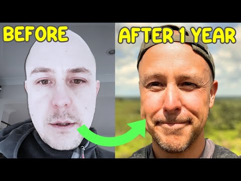 Nasal Breathing While Walking Changed My Health Completely