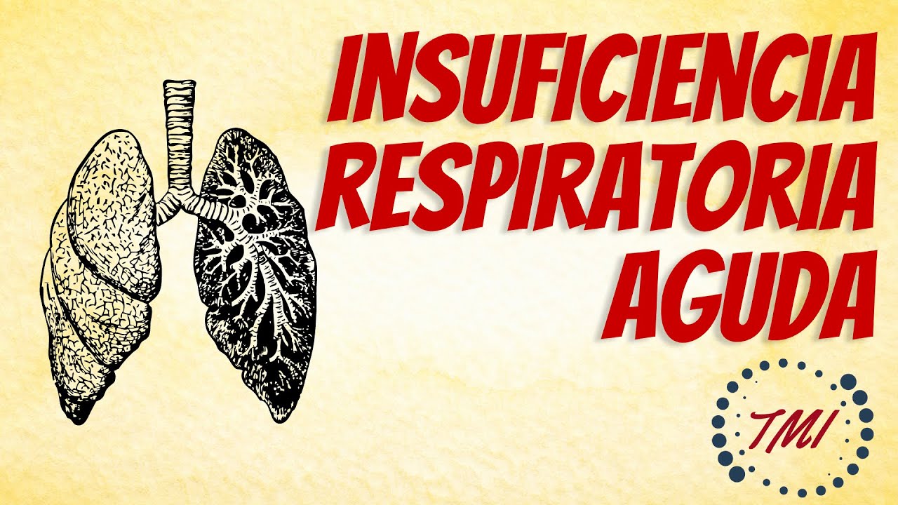 Actualización Insuficiencia Respiratoria Aguda