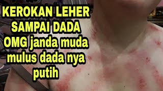 Download lagu kerokan leher dan dada masuk angin  kebanyakan begadang mp3