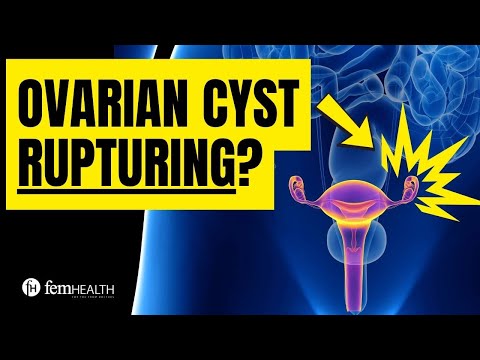 What does an ovarian cyst feel like when it ruptures? What to do for rupturing ovarian cyst?