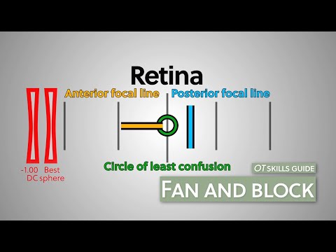 OT skills guide: Fan and block